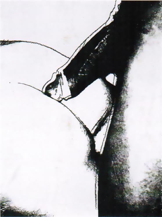 Sex Parts, II.174