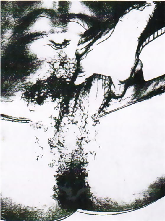 Sex Parts, II.177